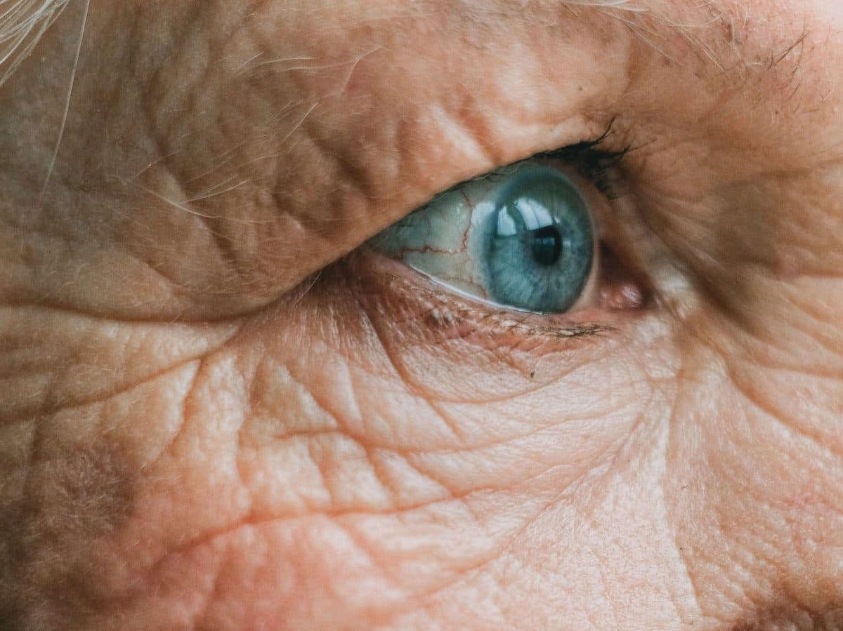 Eyelid Surgery