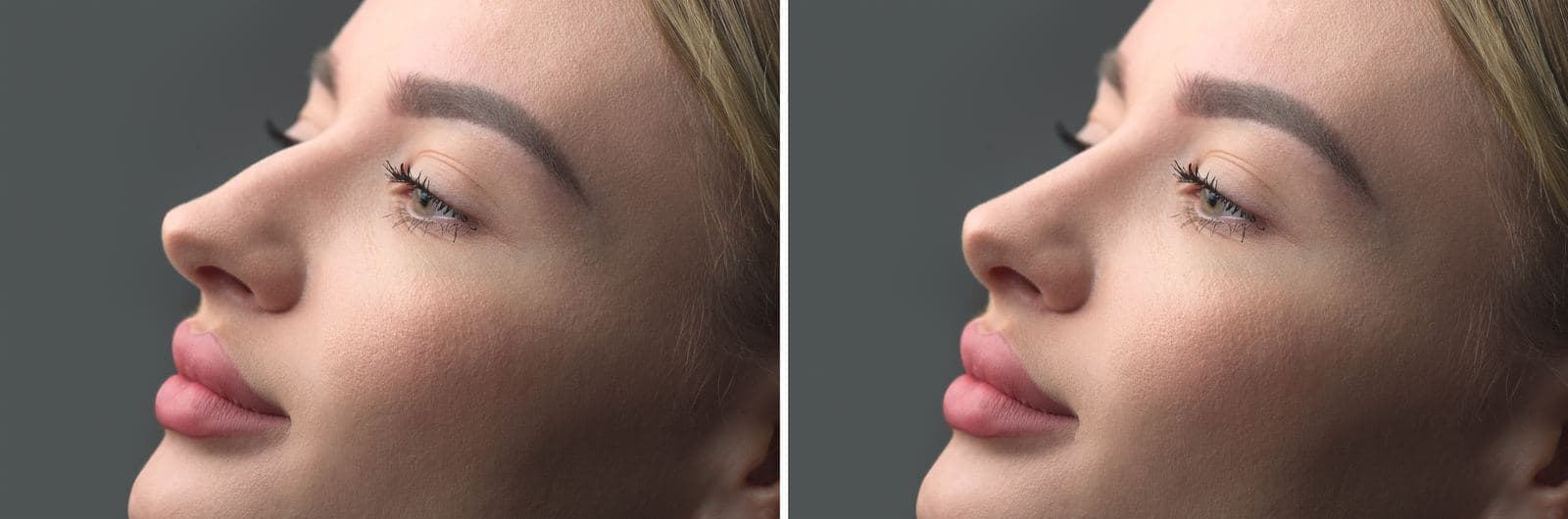 How Much Do Cosmetic Surgeons Charge in Australia? A City-by-City Comparison