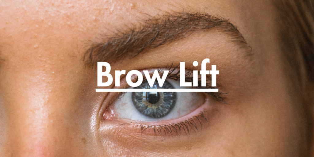 Brow Lift