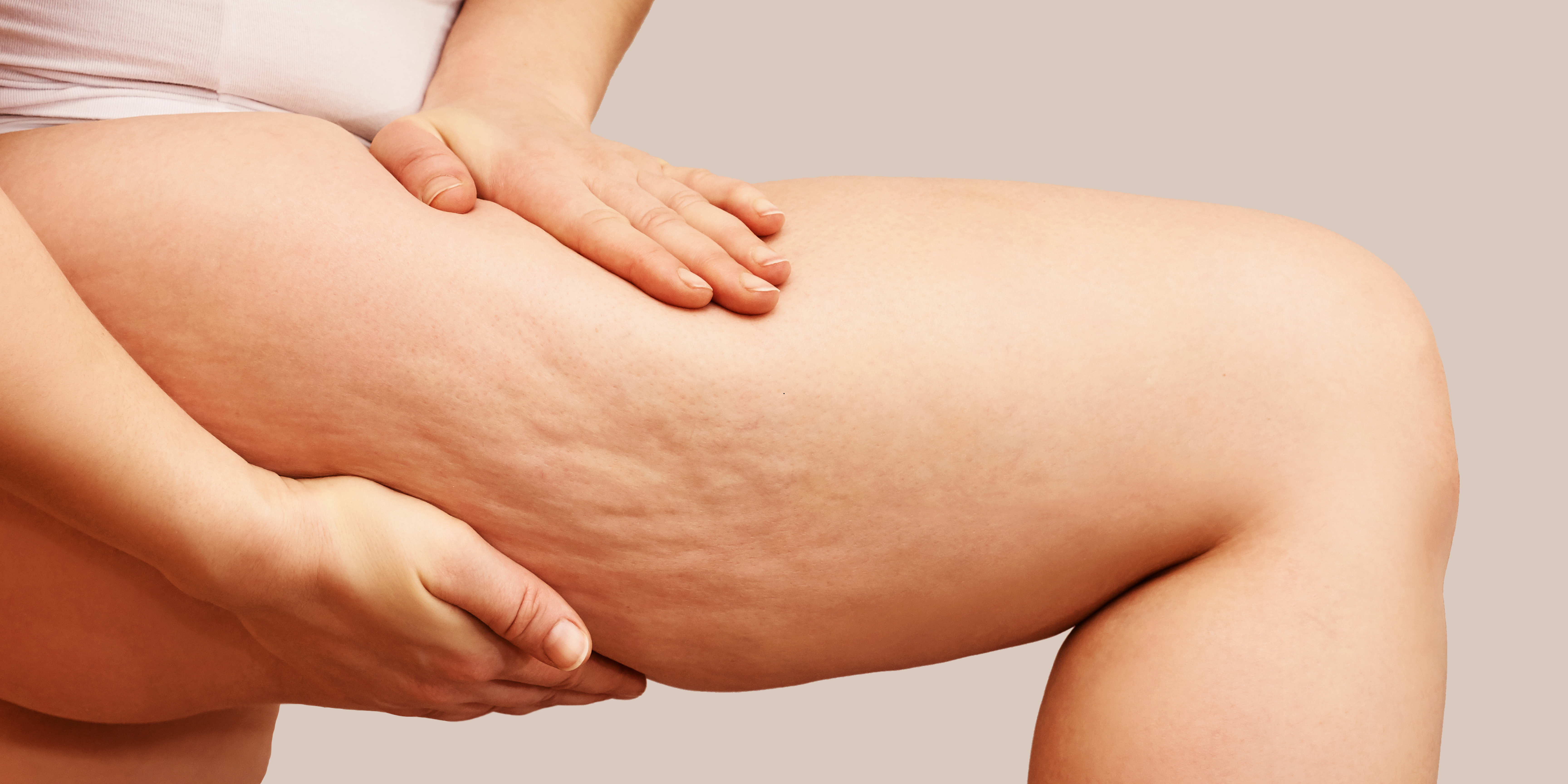 Untitled design (18) cellulite